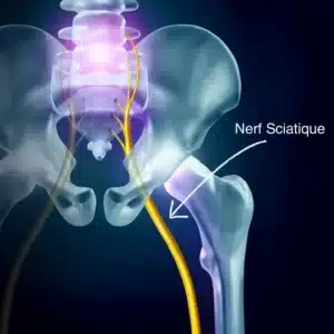 Santé chiropratique